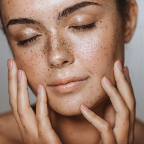 Considerations When Choosing an LED Light Therapy Mask